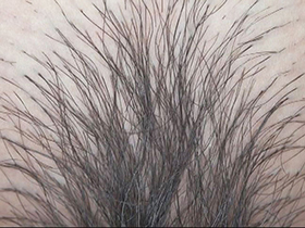 300人のまん毛3　サンプル画像10